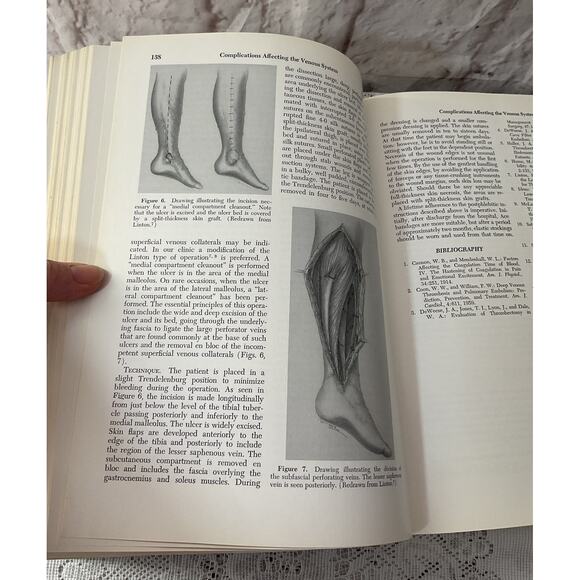1967 Complications In Surgery And Their Management - Picture 7 of 9